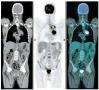Pet Scan -Nordtep: Polyclinique Du Bois Docteurs Bailliez, Blaire Et Petyt, Lille - Horaires d'ouverture