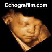 Echografilm Echographie 3D 4D Paris, - Horaires d'ouverture
